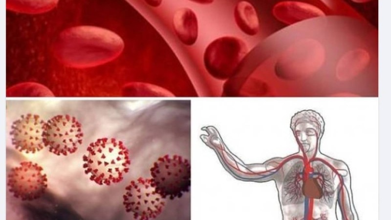 Көп адам тірі қалар еді: Коронавирусты емдеуде тың жаңалық ашылды