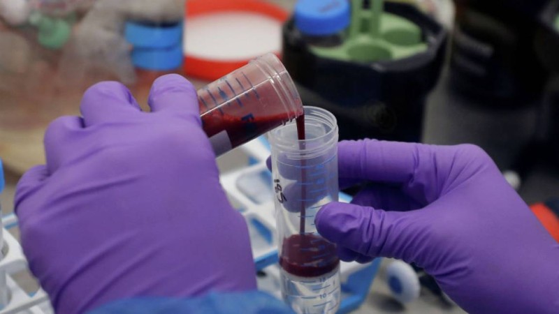 Коронавируспен ауырмаған адамдардан антидене анықталды – ғалымдар себебін айтты