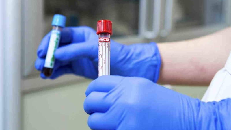 Атырауда науқастан қан үлгілерін алған медбике короновирус жұқтырып алды - Қазақстан жаңалықтары