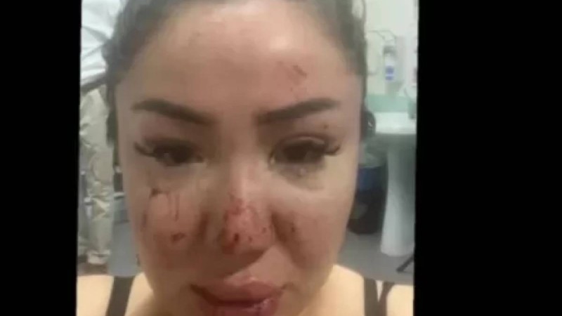 "Барлық дәлелді жариялап, өзімді өлтіремін": Желіде Әнару Құрманәлиева тосын мәлімдеме жасады