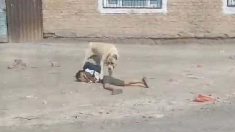 Ит талаған мектеп оқушысының жағдайы белгілі болды