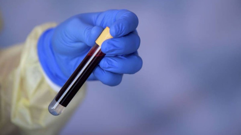 Президент дәрігерлер үшін қылмыстық жазаны өзгертуді ұсынды