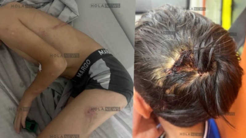 «Қазақмыс» қызметкері азаптаған 8 жасар баланың анасы көмек сұрады