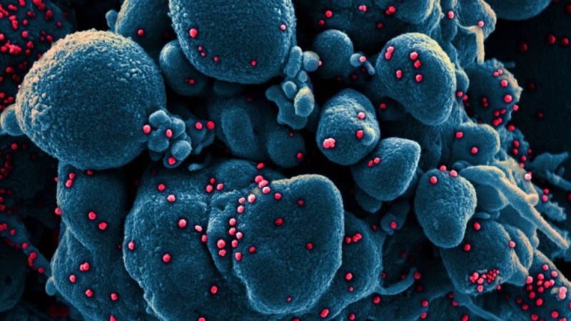 COVID-19 - бұл тек бастамасы. Тағы 850 мың белгісіз вирус адамзатқа үлкен қауіп төндіріп отыр