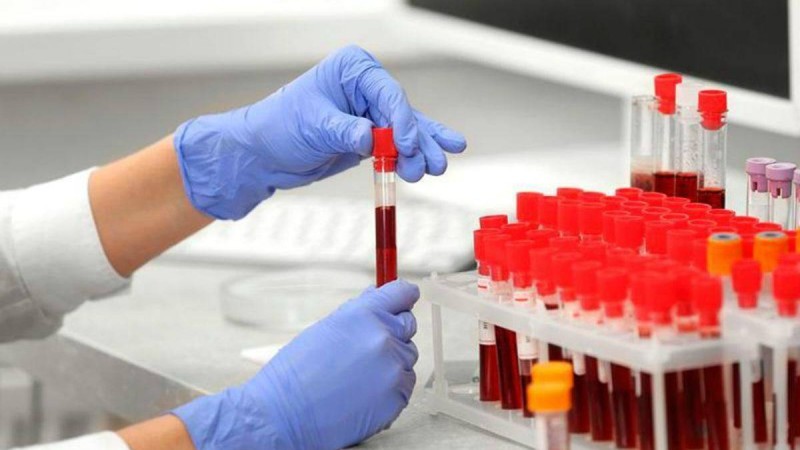 Коронавирус жұқтырған қарағандылық екі қыз Франциядан ұшып келген - Қазақстан жаңалықтары