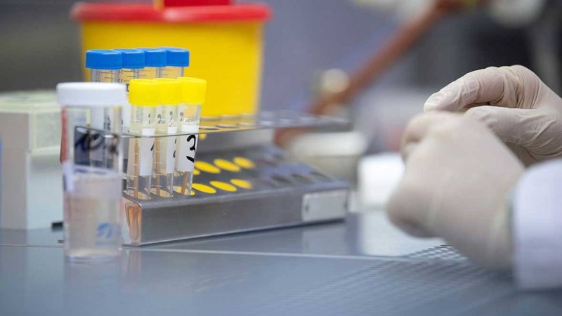 Қазақстанда коронавирус жұқтырғандар саны 67-ге жетті - Қазақстан жаңалықтары