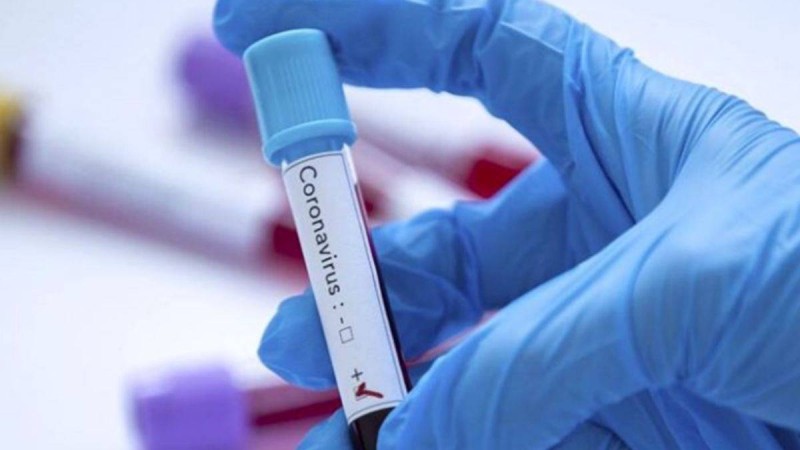 Қарағанды ​​облысында коронавирустың өршуі: жұқтырғандар жайлы не белгілі - Қазақстан жаңалықтары