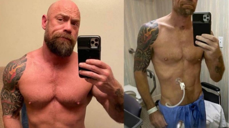 Медқызметкер коронавирустан кейін күрт өзгерген денесін көрсетті - Қазақстан жаңалықтары