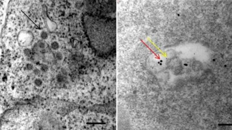 Адамның жасушаларында коронавирустың екінші "есігі" табылды - Қазақстан жаңалықтары
