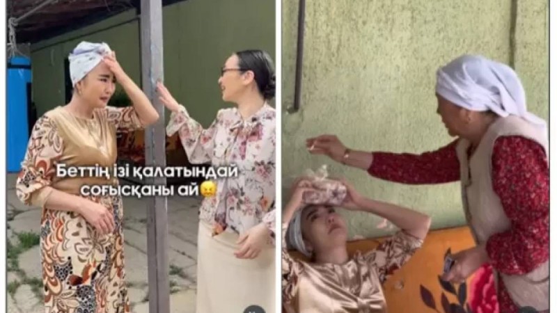 "Бағанға соғылды": "Балқия" есімімен танылған актриса Нұргүл Мыңғатова түсірілім алаңында жарақат алды