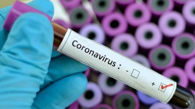 Коронавирус жұқтырған тағы бес адам тіркелді - Қазақстан жаңалықтары