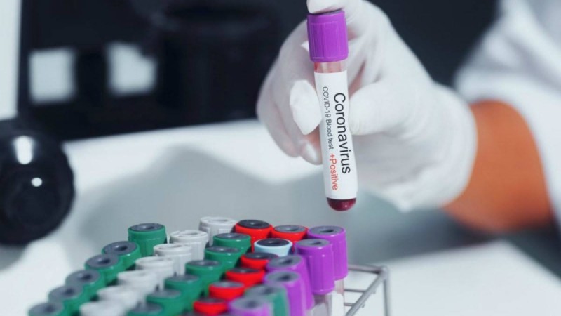 Будапеште қазақстандық әйел коронавируспен ауруханаға түсті - Қазақстан жаңалықтары