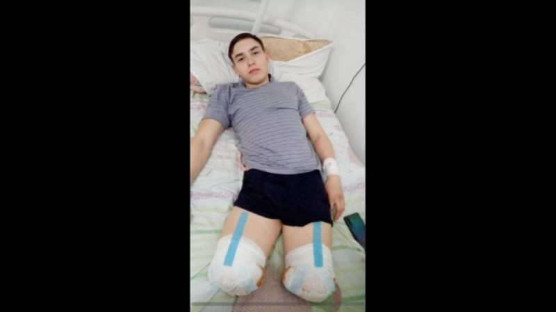 "Өмір мұнымен бітпейді": Қарағандылық студент теміржолдағы оқиға салдарынан аяқсыз қалды