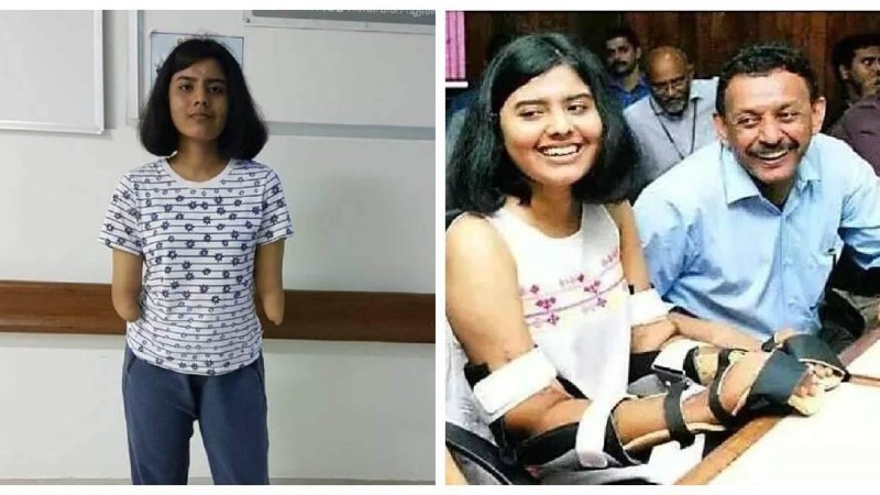 Ер азаматтың қолы трансплантацияланған: Ота жасалған бойжеткеннің қолы бір жылдан кейін ағарып, түктері жоғалды - Қазақстан жаңалықтары