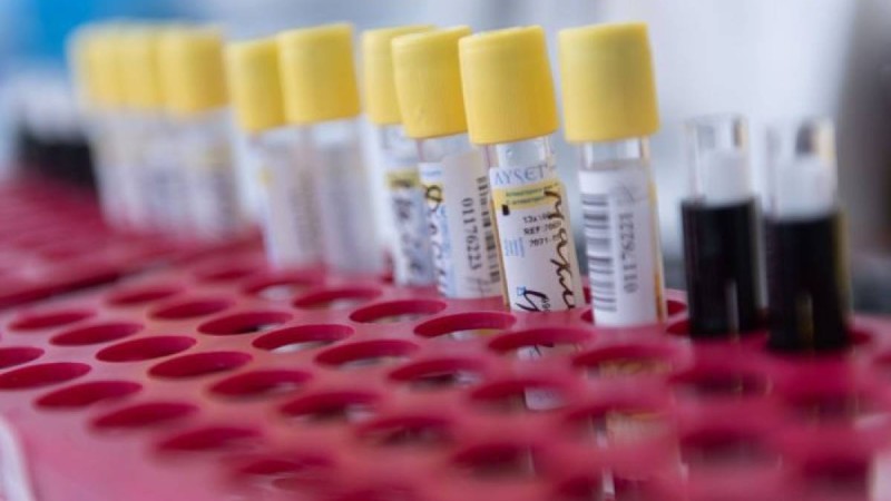 Белгілі құқық қорғаушы Өтебековтің шағымына инфекционист дәрігер жауап берді