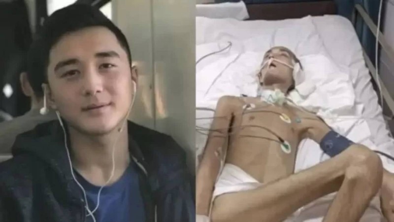 Түркиядан оралған Ербаян Мұхтарды қазақстандық дәрігерлер аяққа тұрғыза ала ма – министрдің жауабы