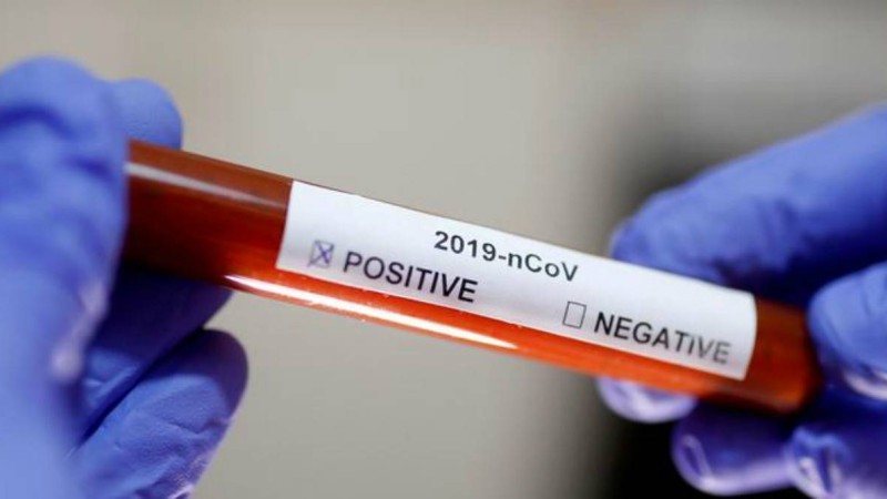 Қазақстанда коронавирустың үшінші жағдайы тіркелді - Қазақстан жаңалықтары