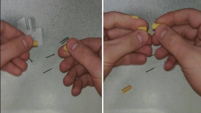 Ішінде шегесі бар асқазан дәрісі түсірілген видео таралып жатыр (видео)