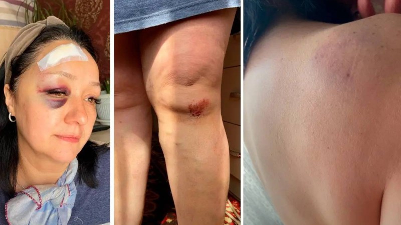 Алматыда әйелді темір сойылмен ұрған адамға қатысты қылмыстық іс қозғалды