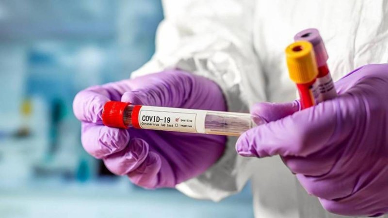 Қазақстанда коронавирус жұқтырғандар күрт өсті