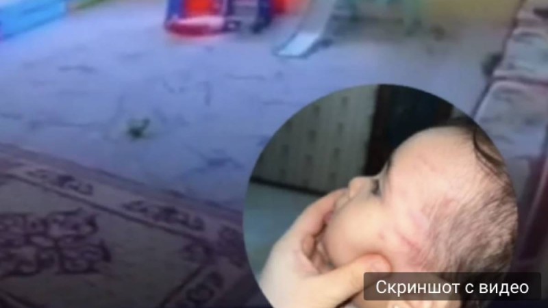 Балабақшаға екі күн барған сәбиді қызметкер ұрып тастаған (видео)