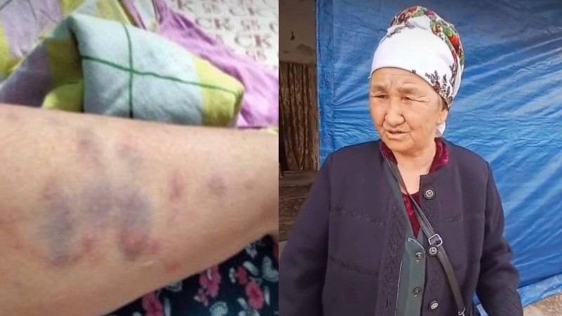 «Балам мен келінім аяусыз ұрып-соғады»: Туған ұлынан зәбір көрген қарт әжей көпшіліктен көмек сұрады (ВИДЕО)