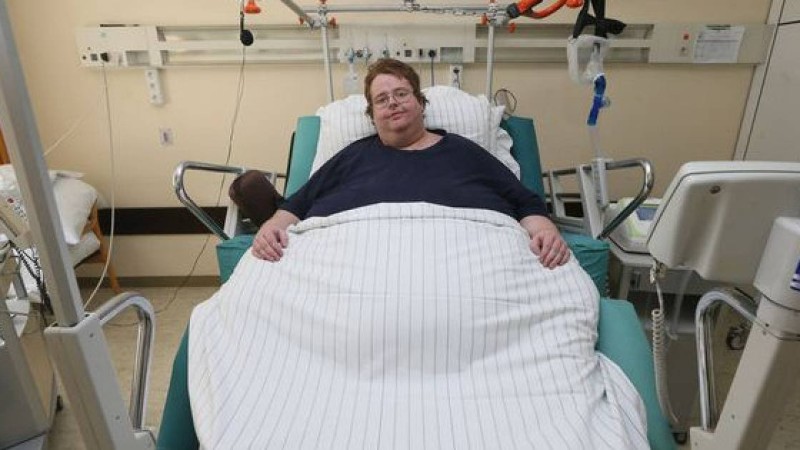 Әуретті жерін байқамаған: Дәрігерлер ер адамға кесар тілігін жасап тастады (фото)