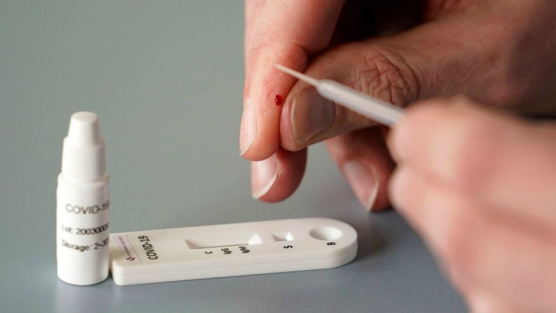 Денсаулық сақтау министрлігі коронавирусқа жасалатын қазақстандық сынақтардың дәлдігін атады - Қазақстан жаңалықтары