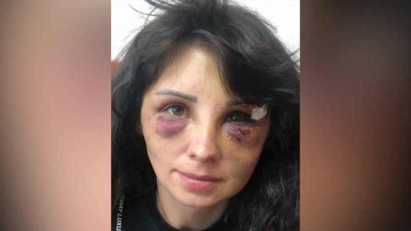 "Мен бәрін сатып алам, ешкім көмектесе алмайды": Азап көрген әйелдің оқиғасы қазақстандықтарды шошытты - Қазақстан жаңалықтары