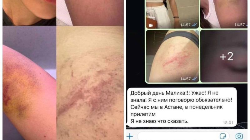 "Соққыға жығып, соңынан аңдыған": Алматылық қызды ұрып-соққан әкімдік қызметкері жұмысынан босатылды