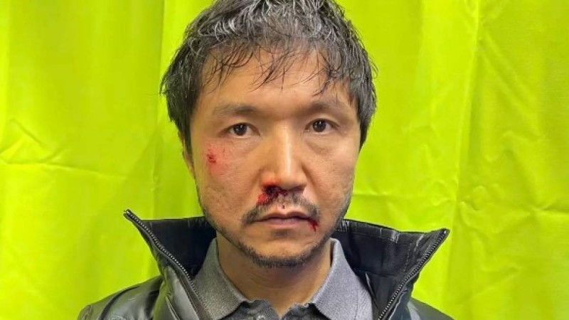 Бет-аузы қан жоса болған Бағлан Әбдірайымовтың суреті жұртты шошытты (фото, видео)