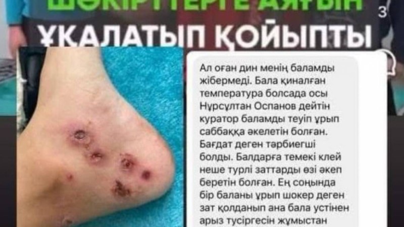 «Электрошокер, дедовщина»: Журналист Ораз Әлімбек Смановтар медресесіне қатысты тағы бір сұмдық жайттың бетін ашты