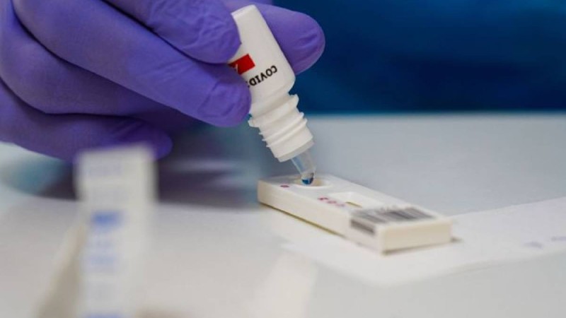 Есмағамбетова отандық тест қашан қолданысқа шығатынын айтты