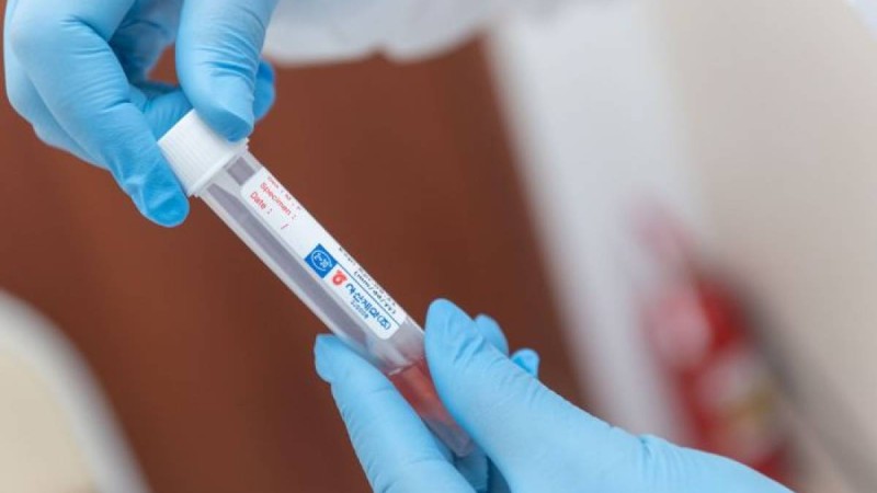 Ресейде COVID-19 індетінен көз жұмғандар саны 7,4 есе төмен