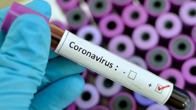 Қытайлық дәрігерлер коронавирустың өкпеге тигізетін әсерін айтты - Қазақстан жаңалықтары