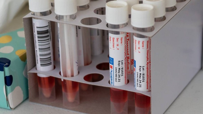 Өскемендегі оң нәтиже көрсеткен ПТР сынақтарының жартысы жалған болып шықты