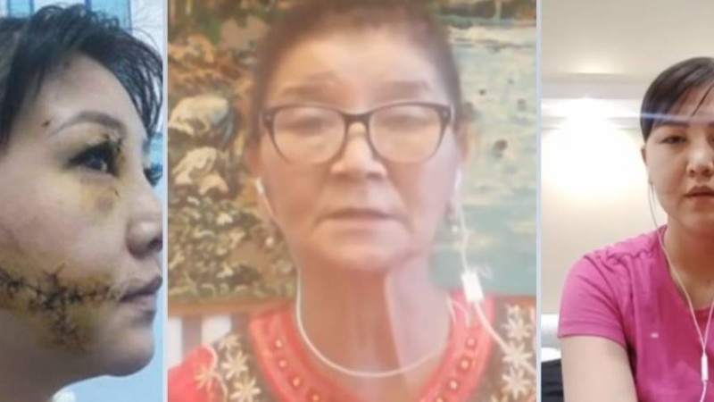"Айнагүлдің басшысы онымен кездесіп жүргенін айтқан": Ақтөбеде бұрынғы әйелінің бетін тілгілеп тастаған азаматтың оқиғасы - Қазақстан жаңалықтары