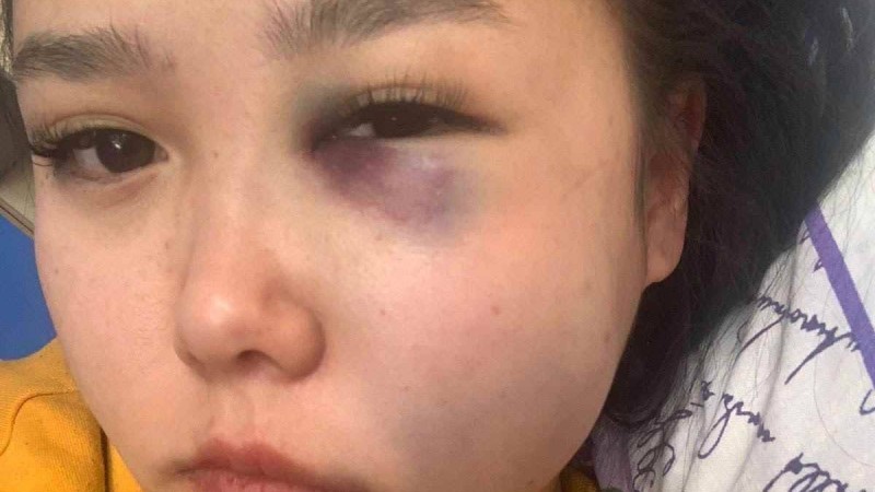 "Қорлауға тырысты, тойтарыс берген соң ұрды": Қостанайда бойжеткенді куәгерлердің көзінше зорламақ болған - Қазақстан жаңалықтары