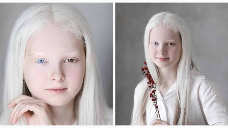 Тылсым сұлулыққа ие 11 жасар қыз әлем жұртын таңқалдырды - Қазақстан жаңалықтары