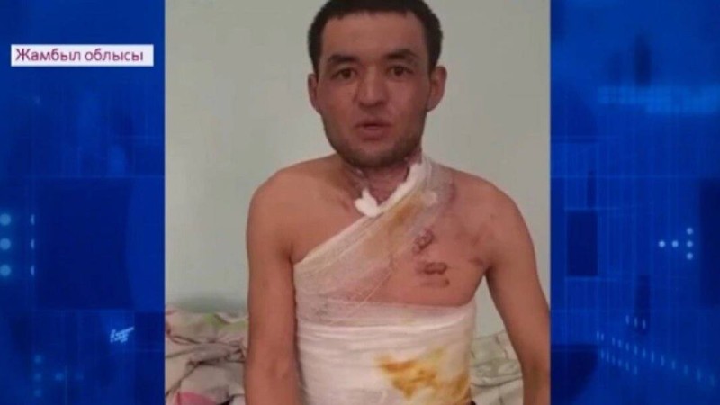 Полициядан қысым көргенін айтқан Жамбыл облысының тұрғыны өзін өртеп жіберді