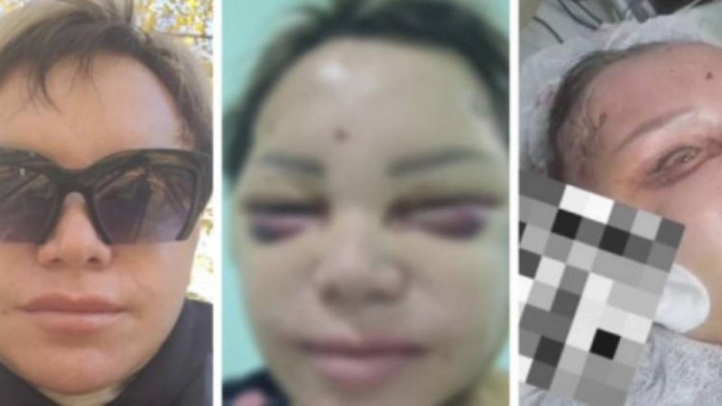 Сұлулық салонына барған көкшетаулық тұрғын мерт бола жаздаған