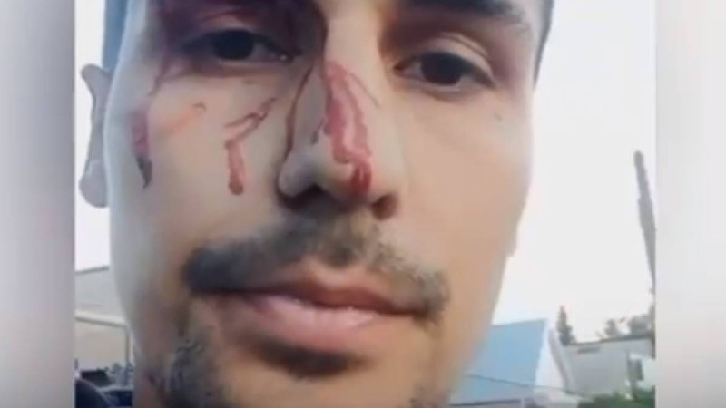 Тоқаевқа шындықты айтқан жігітті әкімдік қызметкерлері соққыға жыққан (ВИДЕО)