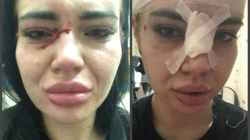 "Олар мені таптап өтті": Қарағандыдағы түнгі клубтағы төтенше жағдай - Қазақстан жаңалықтары