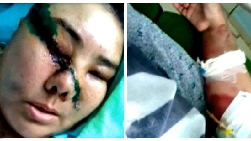 "Күйеуі көшеде басын жарып, қолын шапқылап кеткен": Түркістан облысында жантүршігерлік оқиға болды - Қазақстан жаңалықтары