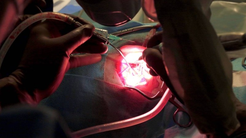 Пәтердегі жөндеу жұмыстары мен құлаққа жасалатын операциялардың арасында қандай ұқсастық бар?