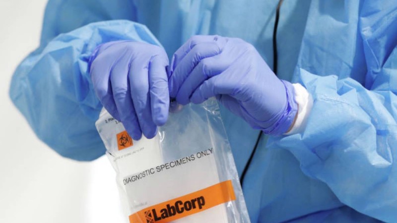 Қазақстанда төрт журналист COVID-19 жұқтырды  