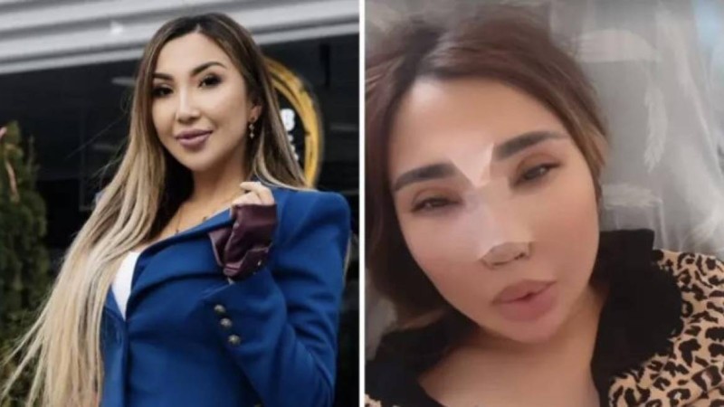 "Үсті-басым қан болды". Сиви Махмуди жан түршігерлік жол апатына түскенін айтты