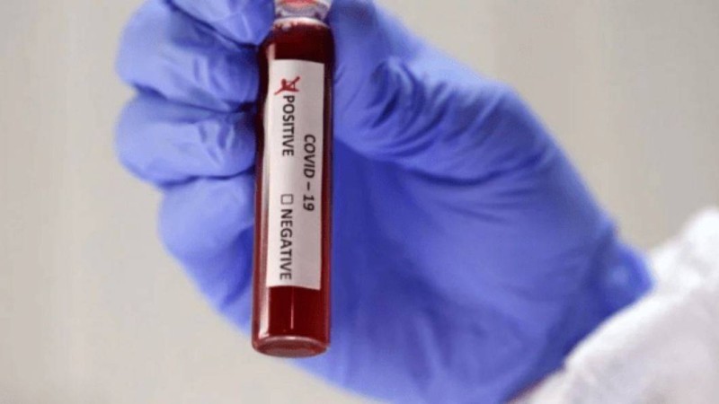 Қазақстанда коронавирустың 8 жаңа жағдайы анықталды