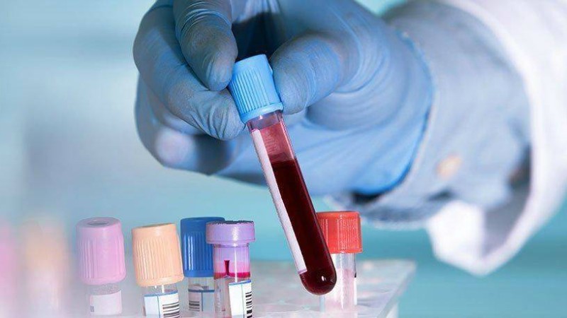 Қатерлі ісікке ең төзімді қан тобы анықталды - Қазақстан жаңалықтары