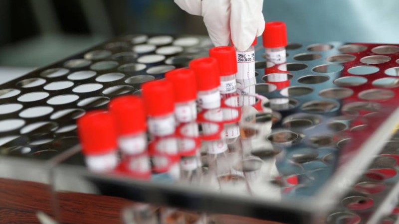 Коронавирус жұқтырғандар саны күрт көбейді